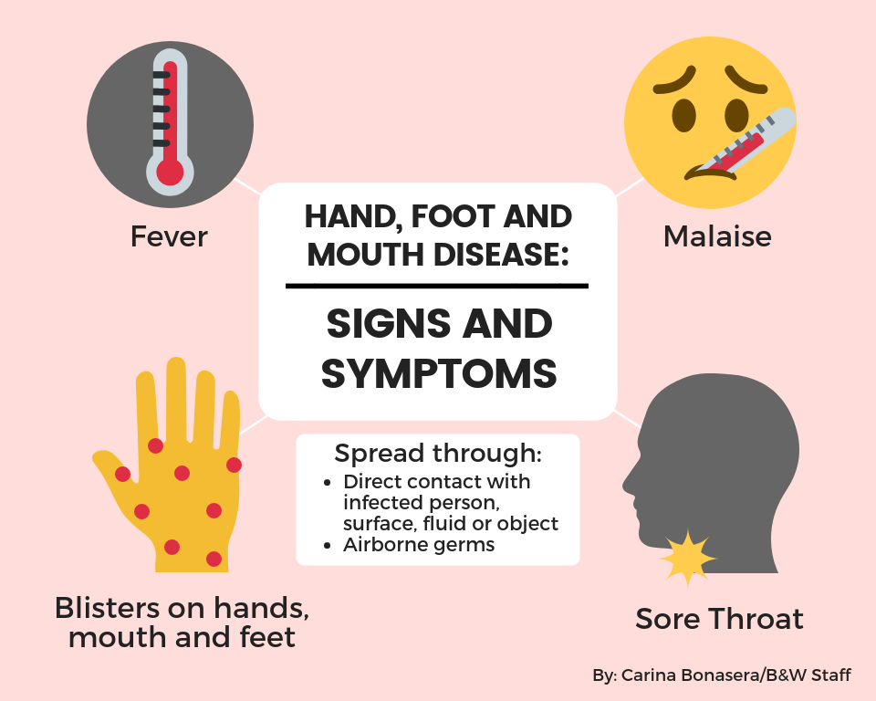 Hand Foot Mouth Disease Stages