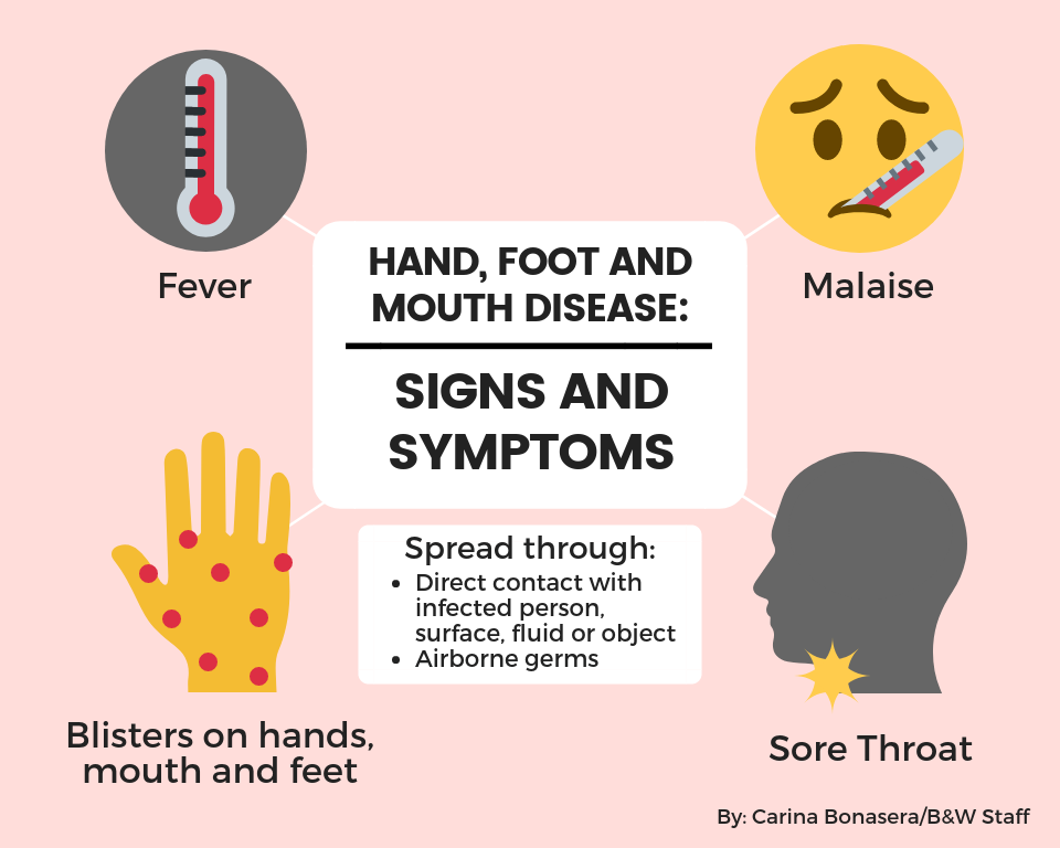 Hand, foot and mouth disease plagues college campuses